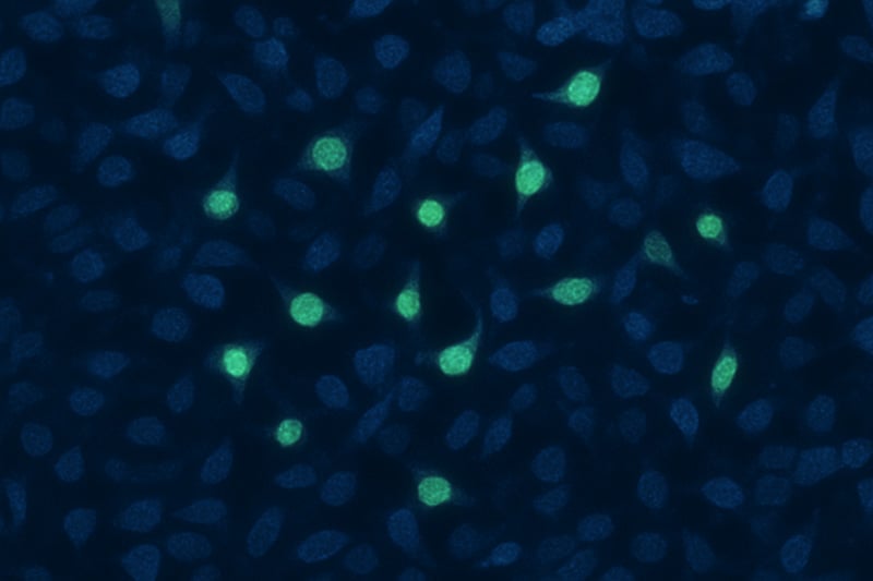 miRNA, lncRNA & Flüssigbiopsie 27NOV2025 miRNA, lncRNA & Flüssigbiopsie 27NOV2025