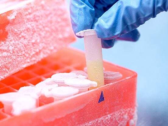 Cellbanker-cell-freezing-feature Cellbanker-cell-freezing-feature